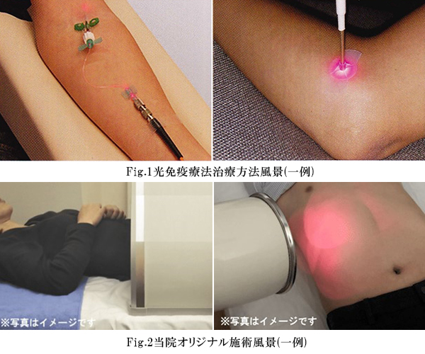 当院の光免疫療法とは