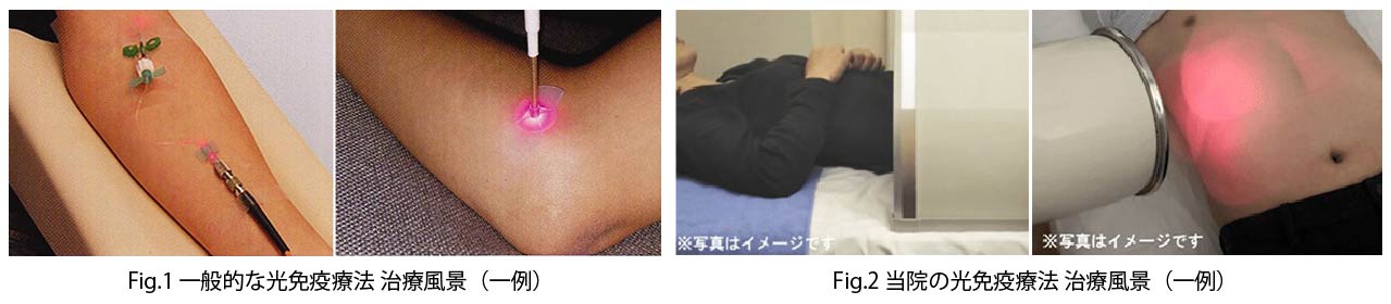 当院の光免疫療法とは