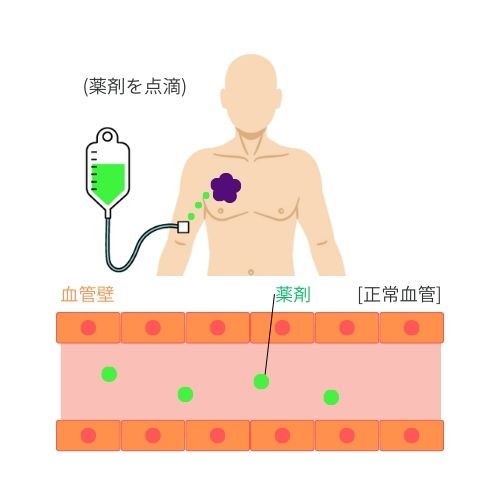 ➀ 薬剤を点滴
