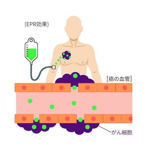 ➁ 薬剤をがん細胞へ集積