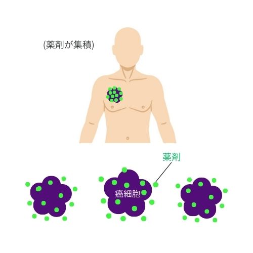 ➂ 2日目 薬剤を保持