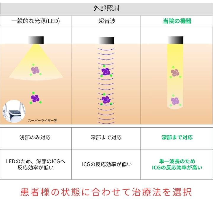 選択的波長の有効性