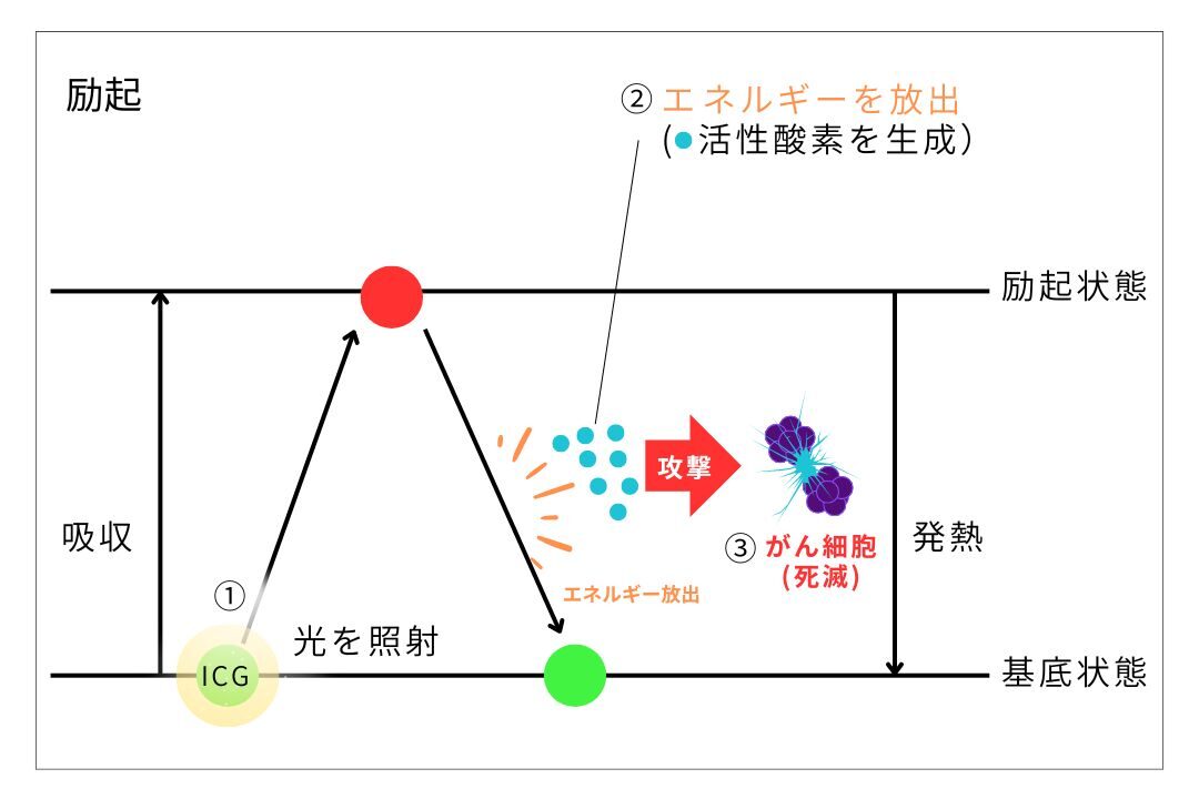 励起のメカニズム